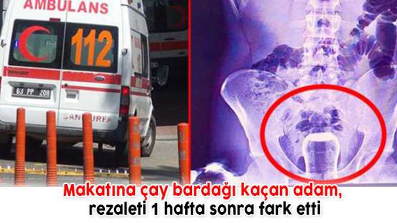 Makatına çay bardağı kaçan adam, rezaleti 1 hafta sonra fark etti