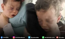 Vahşeti yaşayan 2 yaşındaki bebek hastanelik oldu