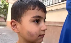 Evde uyuyan çocuğu lağım faresi ısırdı