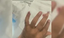 Uy*şturucuyla yakalanan şüpheli, polisin parmağını kopardı