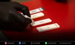Büyükşehir’den kimliksiz ve ücretsiz test hizmeti