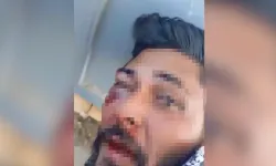 Taciz şüphelisini dövüp, jandarmaya teslim ettiler