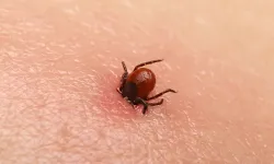 KKKA tedavisi gören kadın hayatını kaybetti