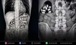 İzmir Havalimanı’nda 495 gram metamfetamin ele geçirildi