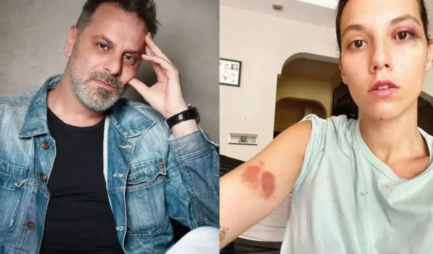 Oyuncu Ozan Güven'in cezası onandı